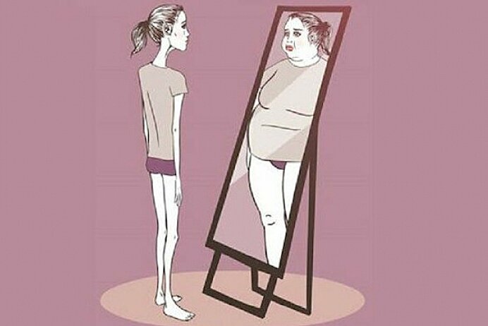 Yanlış Beden Algısı: Anoreksiya Nevroza